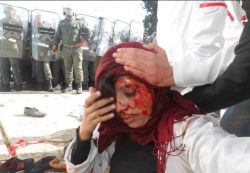 injured protesterw